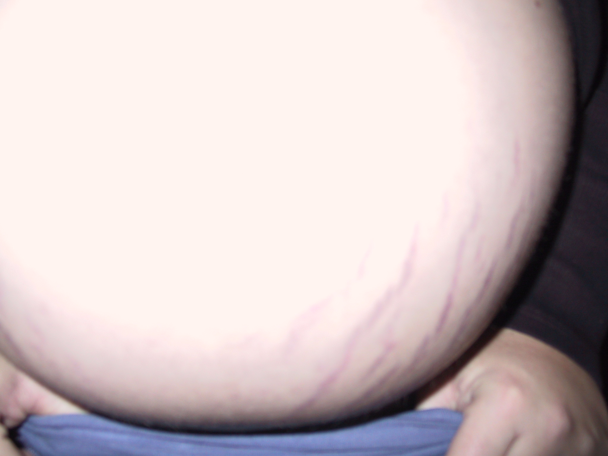 The Baby Belly